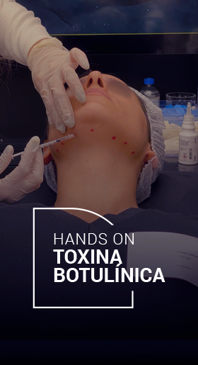 Hands On Toxina Butolínica