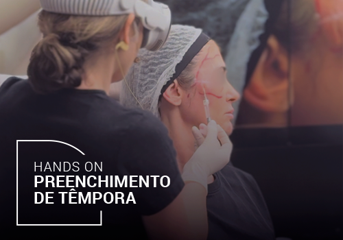 Hands On Preenchimento de Têmpora