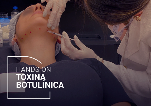 Hands On Toxina Botulínica