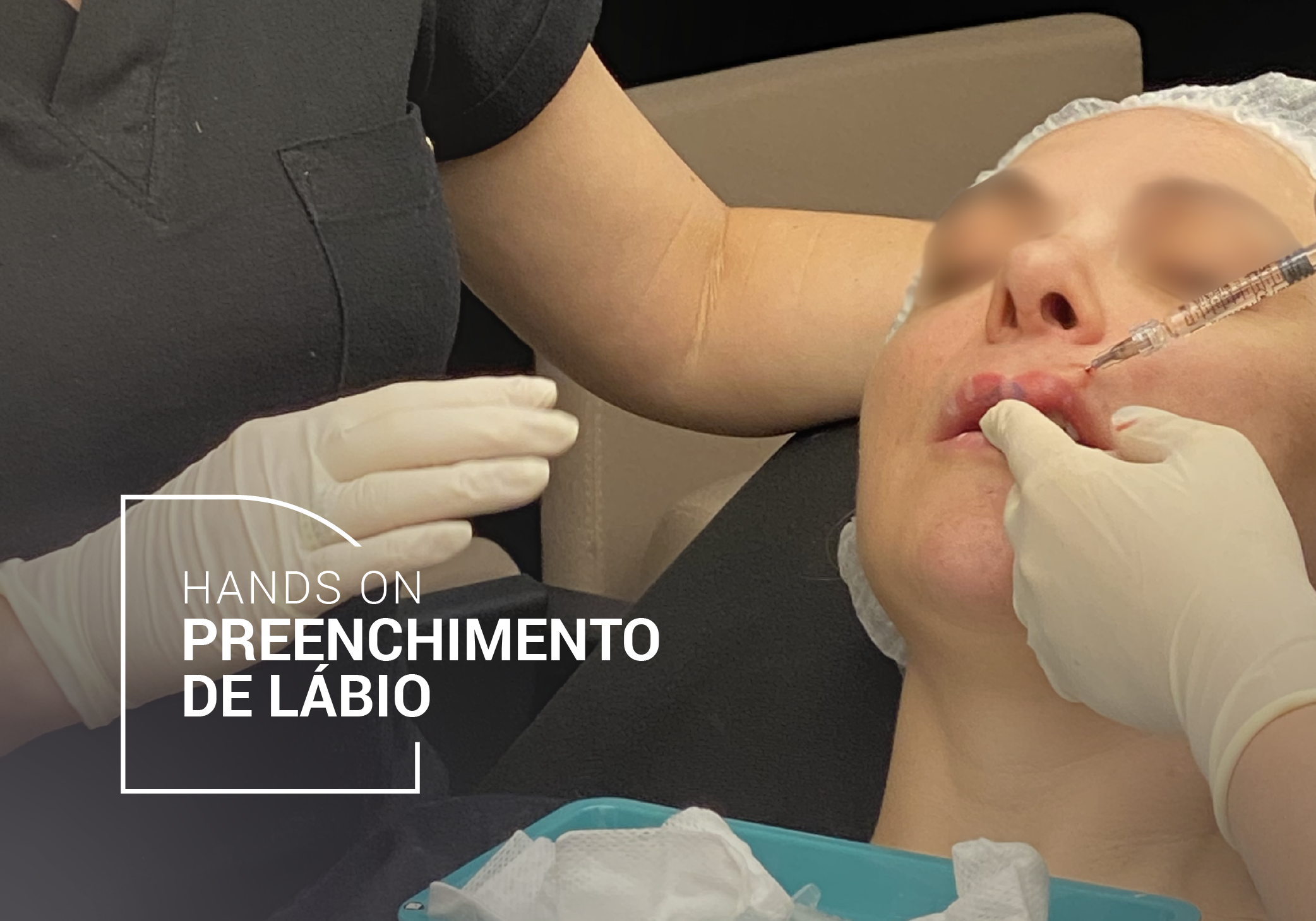 Hands-On Preenchimento de lábio HORIZONTAL
