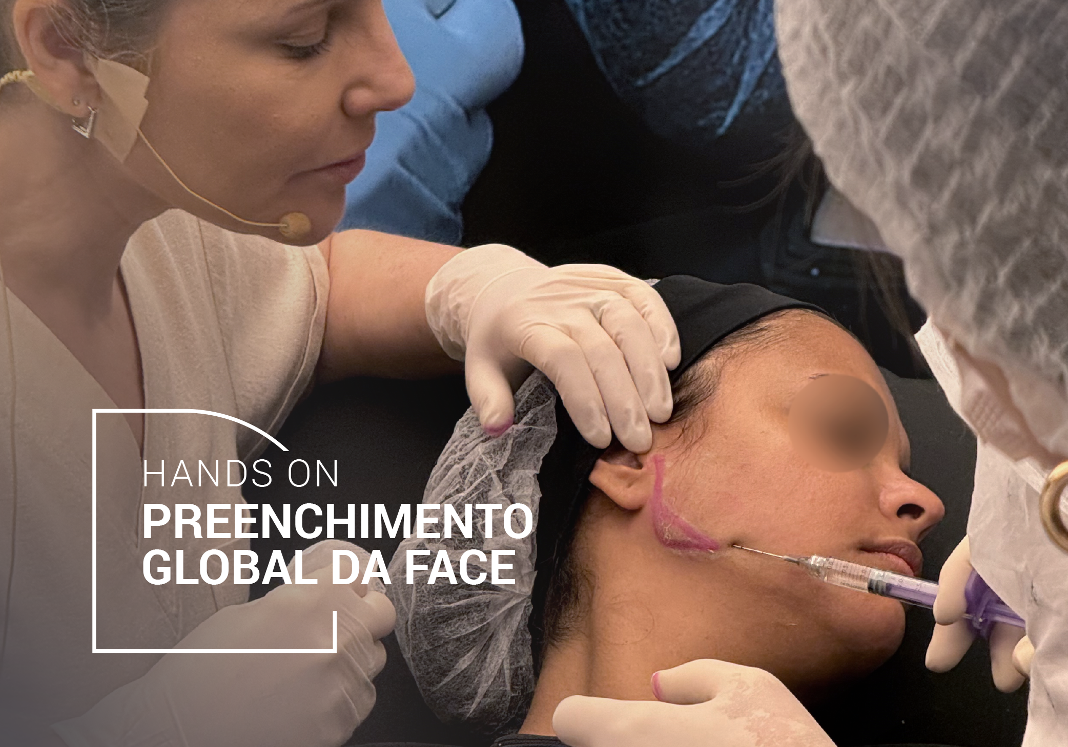 Hands-on Preenchimento global da face HORIZONTAL